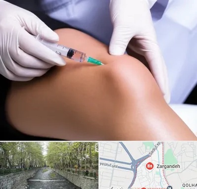 پلاسما درمانی PRP در زرگنده