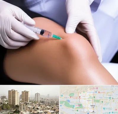 پلاسما درمانی PRP در منطقه 5 تهران