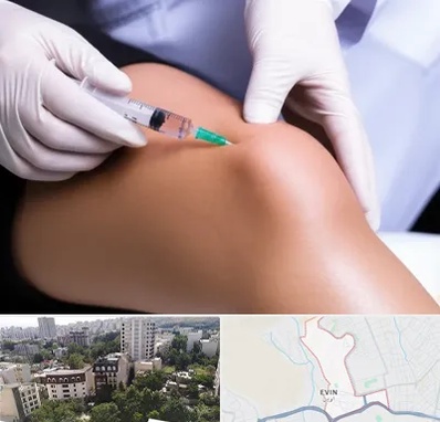 پلاسما درمانی PRP در اوین 