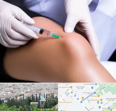 پلاسما درمانی PRP در محلاتی شیراز 