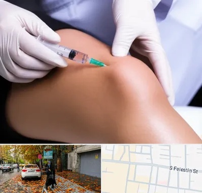 پلاسما درمانی PRP در خیابان فلسطین