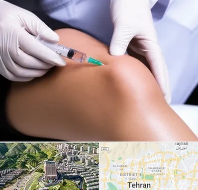 پلاسما درمانی PRP در شمال تهران 