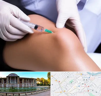 پلاسما درمانی PRP در عفیف آباد شیراز 