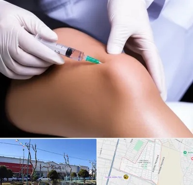 پلاسما درمانی PRP در فاز دو اندیشه