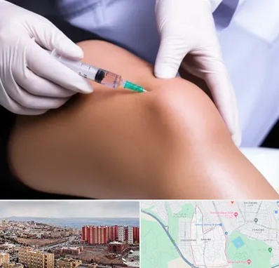 پلاسما درمانی PRP در سهند تبریز 