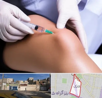 پلاسما درمانی PRP در اتابک