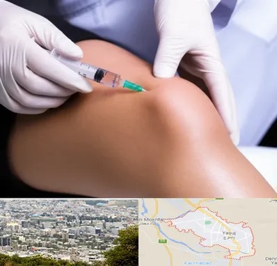 پلاسما درمانی PRP در یاسوج