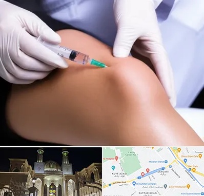 پلاسما درمانی PRP در زرگری شیراز 