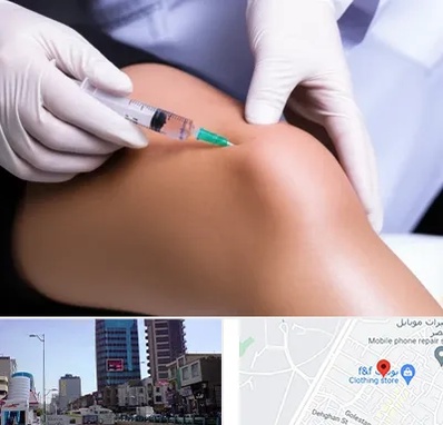 پلاسما درمانی PRP در چهارراه طالقانی کرج 