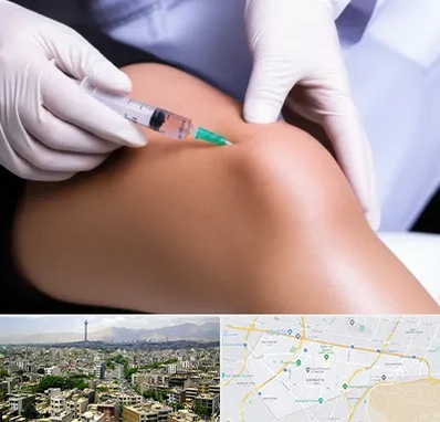 پلاسما درمانی PRP در منطقه 8 تهران