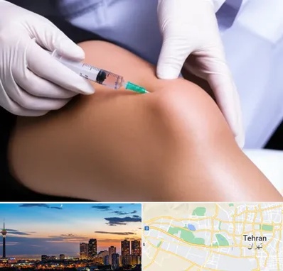 پلاسما درمانی PRP در غرب تهران 