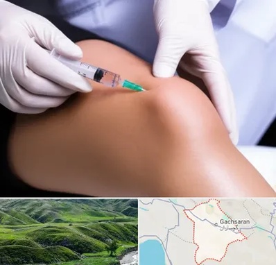 پلاسما درمانی PRP در گچساران