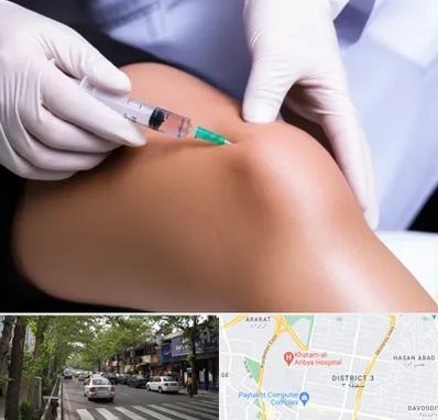 پلاسما درمانی PRP در ظفر