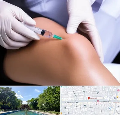 پلاسما درمانی PRP در هشت بهشت اصفهان 