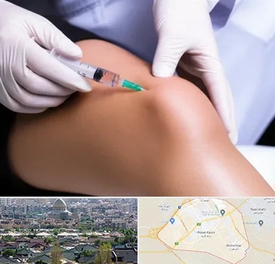 پلاسما درمانی PRP در رباط کریم