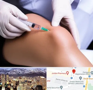 پلاسما درمانی PRP در جردن 