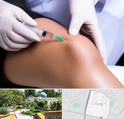 پلاسما درمانی PRP در باغمیشه تبریز 