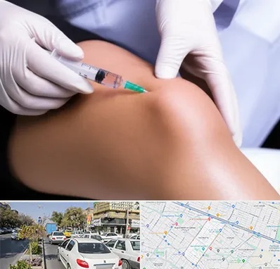 پلاسما درمانی PRP در مفتح مشهد 