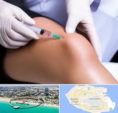 پلاسما درمانی PRP در کیش