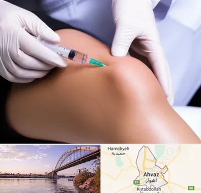 پلاسما درمانی PRP در اهواز