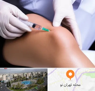 پلاسما درمانی PRP در تهران نو