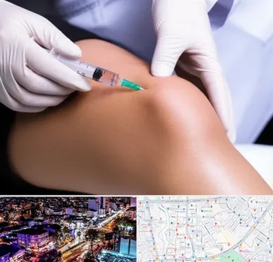 پلاسما درمانی PRP در منظریه رشت 