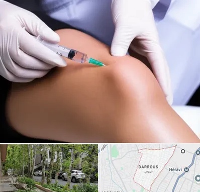 پلاسما درمانی PRP در دروس