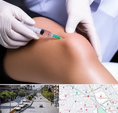 پلاسما درمانی PRP در خیابان زند شیراز 