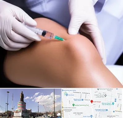 پلاسما درمانی PRP در کارگر جنوبی