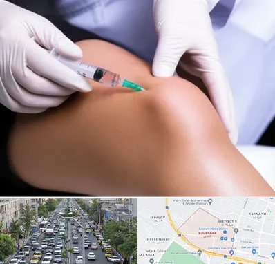 پلاسما درمانی PRP در گلشهر کرج 