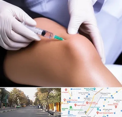 پلاسما درمانی PRP در شریعتی 