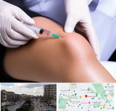 پلاسما درمانی PRP در بلوار فردوسی مشهد 