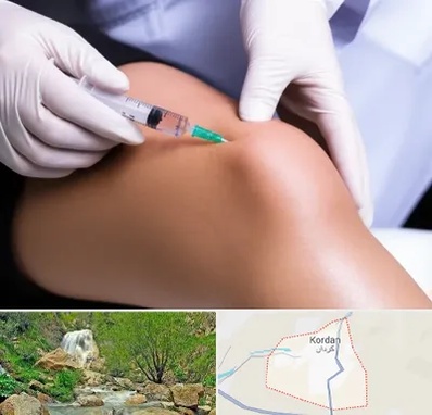پلاسما درمانی PRP در کردان