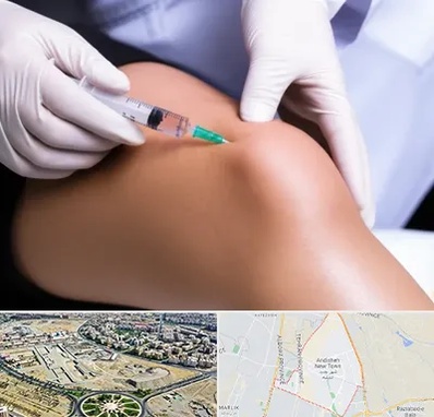 پلاسما درمانی PRP در اندیشه