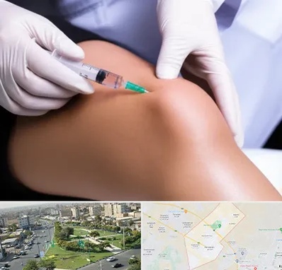 پلاسما درمانی PRP در کمال شهر کرج 