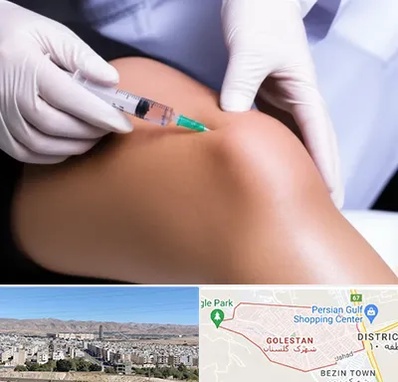 پلاسما درمانی PRP در شهرک گلستان شیراز 