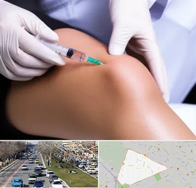 پلاسما درمانی PRP در احمدآباد مشهد 