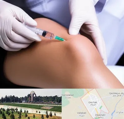 پلاسما درمانی PRP در قرچک