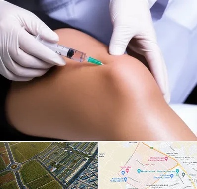 پلاسما درمانی PRP در الهیه مشهد 