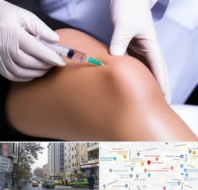پلاسما درمانی PRP در فاطمی