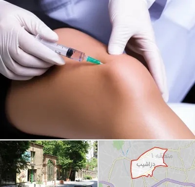 پلاسما درمانی PRP در دزاشیب