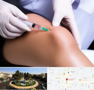 پلاسما درمانی PRP در هفت حوض