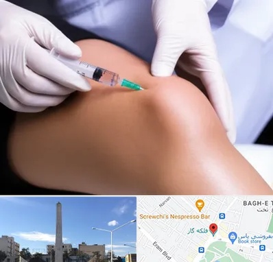 پلاسما درمانی PRP در فلکه گاز شیراز 