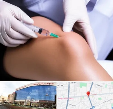 پلاسما درمانی PRP در نصف راه تبریز 