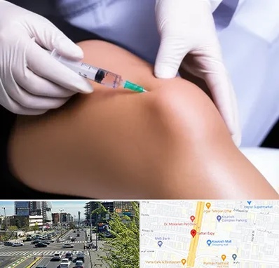 پلاسما درمانی PRP در ستاری 