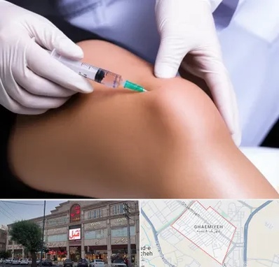 پلاسما درمانی PRP در قائمیه اسلامشهر 