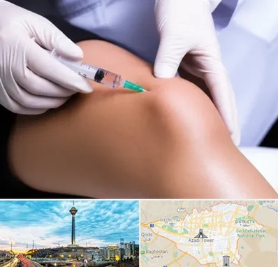 پلاسما درمانی PRP در تهران