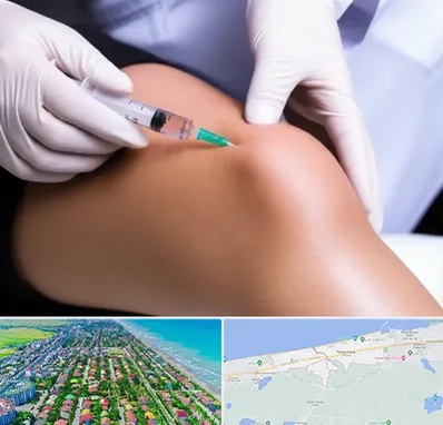 پلاسما درمانی PRP در فریدونکنار