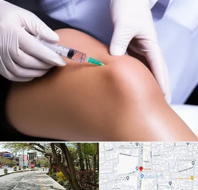 پلاسما درمانی PRP در خیابان توحید اصفهان 