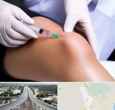 پلاسما درمانی PRP در اندیمشک